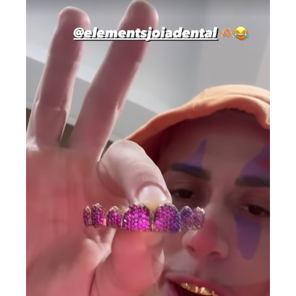 No total, MC Daniel investiu R$ 40 mil nos trêz grillz. Uma verdadeira fortuna!