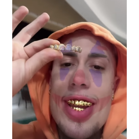 MC Daniel revelou ter comprado três modelos diferentes das próteses para os dentes e disse "gostar da parada"