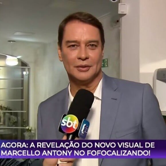 Marcello Antony passou por uma harmonização facial, que teve o resultado revelado no SBT