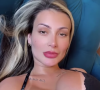 Andressa Urach pegou muita gente de surpresa há pouco mais de uma semana após cortar sua língua no meio