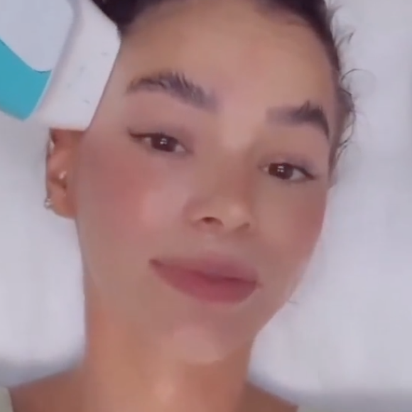 Procedimento feito por Bruna Marquezine trata tanto a flacidez facial quanto a flacidez muscular
