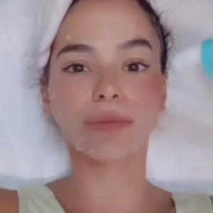 Bruna Marquezine já mostrou em suas redes sociais uma aplicação de Ultrassom Microfocado, brincando que estava com a "pele esticada e zero preenchida"