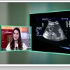 Fernanda Machado mostrou no programa 'Encontro' uma ultrassonografia de seu bebê