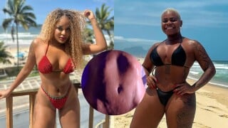 Antes e depois de Cariúcha: apresentadora do 'Fofocalizando' exibe resultado de lipo LAD e causa polêmica. 'Criticou tanto a Jojo...'