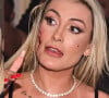 Após ter rosto 'rasgado' com vidro, Andressa Urach trocou mensagem e deixou ameaça para Juju Ferrari