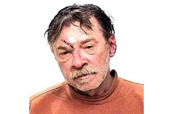 Irmão de Madonna, o mendigo Anthony Ciccone levou pontos no rosto após ser agredido depois de resistir à detenção, na noite de domingo, 21 de abril de 2013