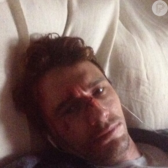 James Franco publicou uma foto após uma cena de luta com o rosto machucado nesta sexta-feira, em 31 de maio de 2013