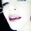 Madonna posta foto no Instagram com joias nos dentes