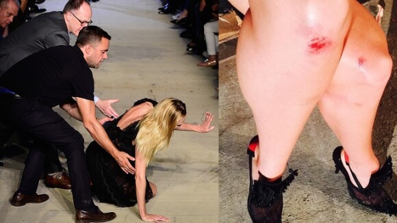 Angel da Victoria's Secret Candice Swanepoel se machuca ao cair na passarela