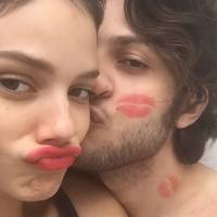 Chay Suede aparece repleto de marcas de beijo em foto de Laura Neiva: 'Que amor'