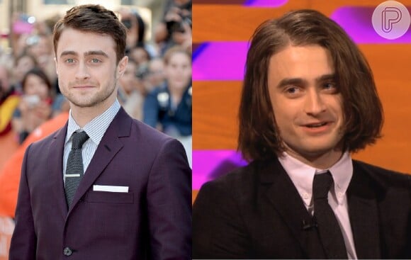 Daniel Radcliffe, o eterno Harry Potter, mudou radicalmente colocando aplique para o seu papel no filme 'Frankenstein'