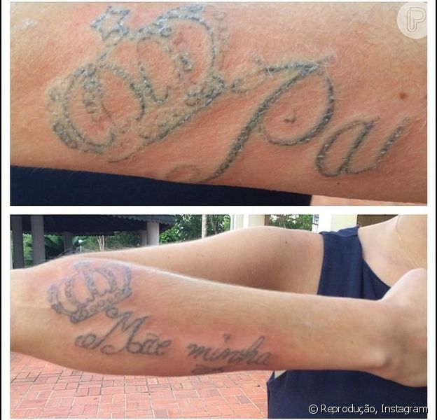 Barbara Evans Mostra Remocao Da Tatuagem Nos Antebracos Trabalho Incrivel Purepeople