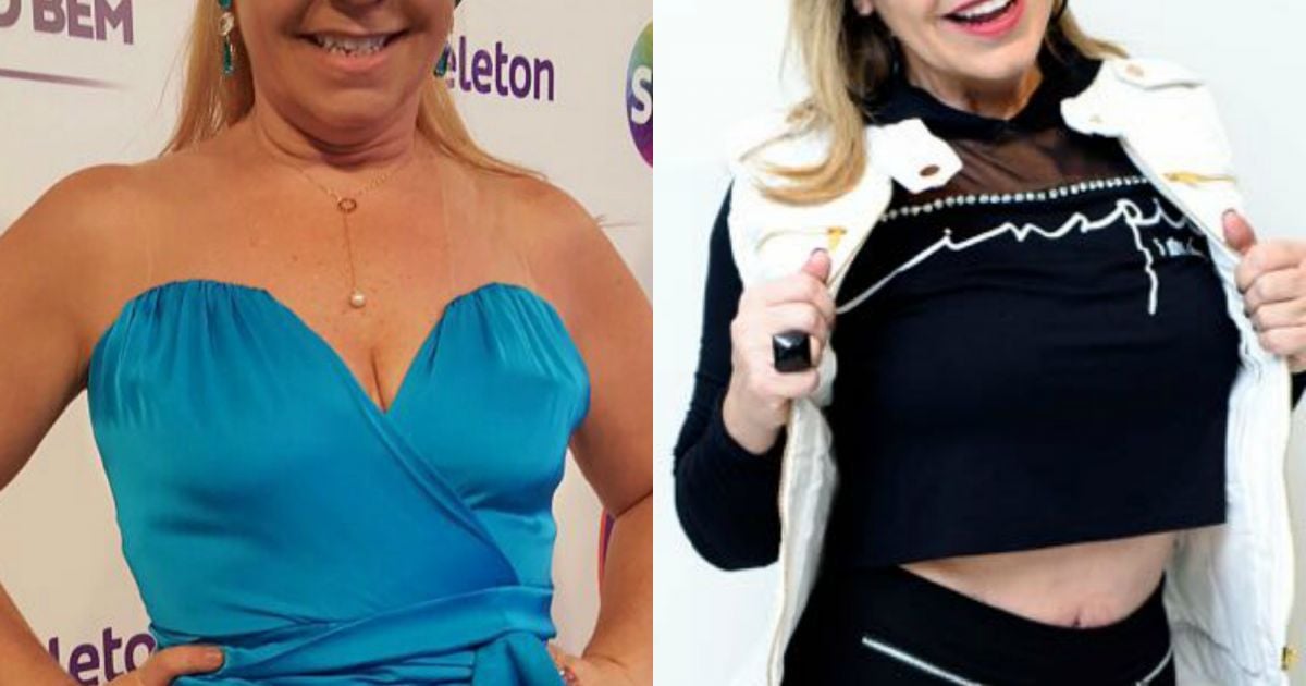 Flor Do Sbt Emagrece 33 Kg E Coloca Silicone Aos 52 Anos Disposicao Purepeople