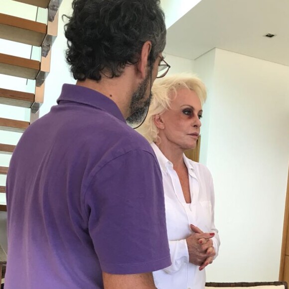 O olho roxo de Ana Maria Braga era parte de uma campanha do Programa Bem Querer Mulher em prol do fim da violência contra a mulher