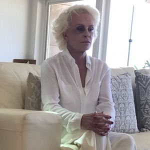 Ana Maria Braga chamou atenção nas redes sociais ao surgir com o olho roxo na quinta-feira, 23 de novembro de 2017