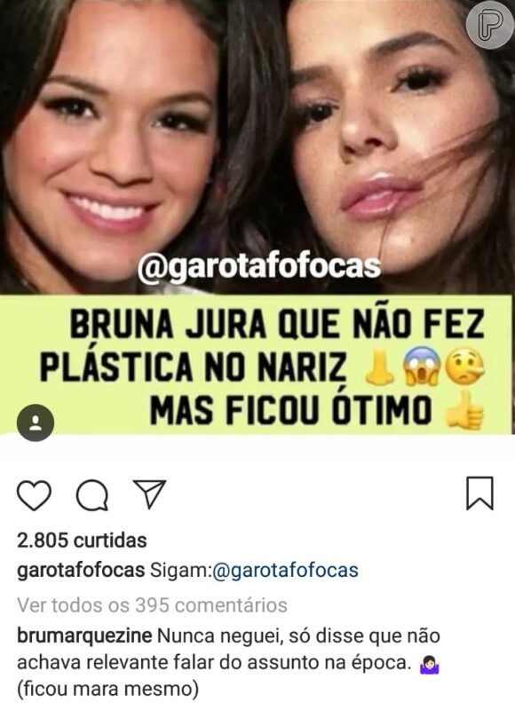 Bruna Marquezine admitiu que fez plástica no nariz em resposta a um perfil do Instagram