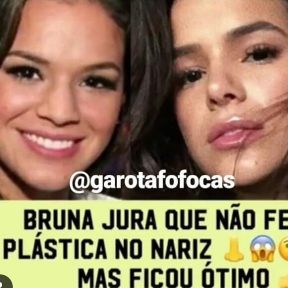 Bruna Marquezine admitiu que fez plástica no nariz em resposta a um perfil do Instagram