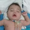 O pequeno Guilherme Barbosa de Jesus tem síndrome de Ondine, uma doença genética rara que afeta o sistema respiratório