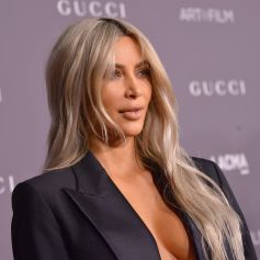 Kim Kardashian já fez harmonização facil