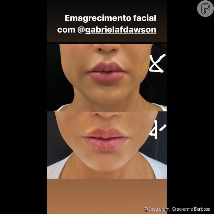 gracyanne barbosa antes e depois