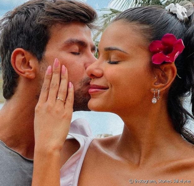 Jakelyne e Mariano mostraram o antes e depois dos narizes em suas redes sociais