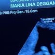 Maria Lina estava grávida de 22 semanas quando deu à luz