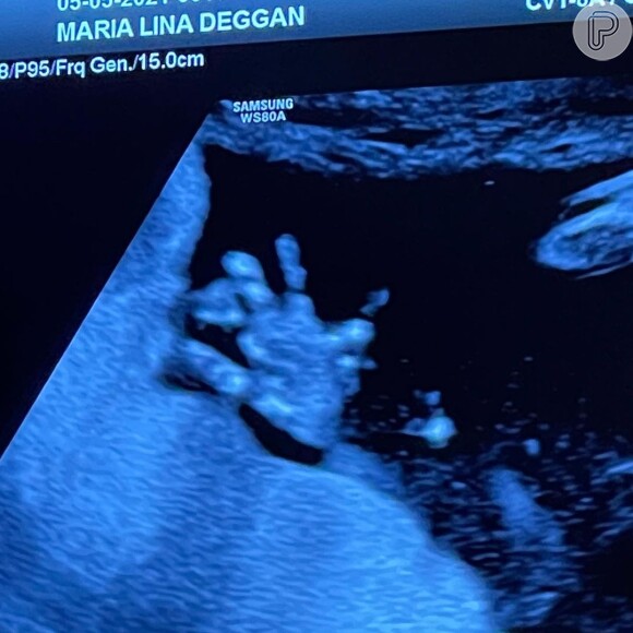 Maria Lina estava grávida de 22 semanas quando deu à luz