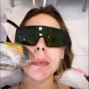 Virgínia Fonseca fez depilação a laser no rosto e mostrou o procedimento em sua rede social