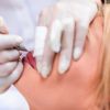 A micropigmentação é usada em tratamentos para lábio leporino e reconstrução da mama