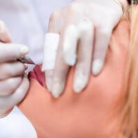 Micropigmentação pode ser aliada no tratamento para lábio leporino e reconstrução de mamas, diz especialista