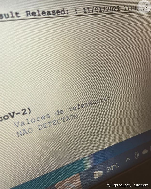 William Bonner publicou resultado de exame no Instagram