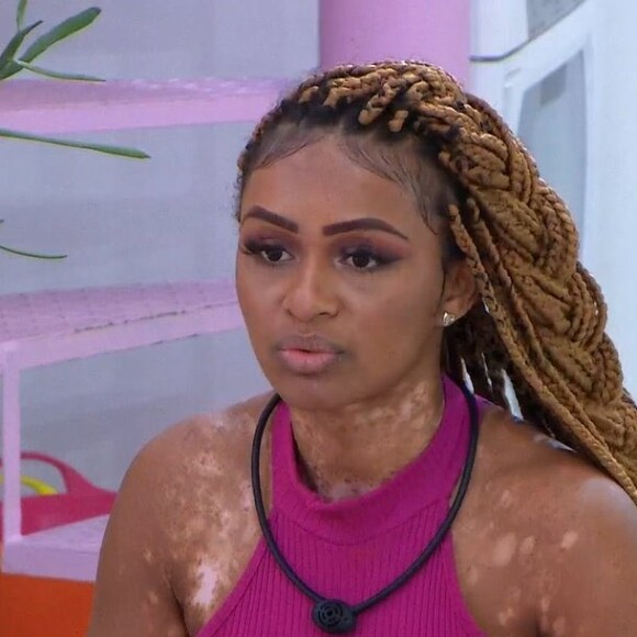 BBB 22: Natália afirma que o pouco conhecimento das pesoas sobre vitiligo trouxe 'traumas muito pesados'