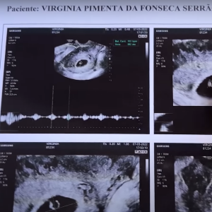 Virgínia Fonseca e obstetra fizeram as contas e deduziram, de acordo com a crença popular, sem base científica, que novo bebê será um menino