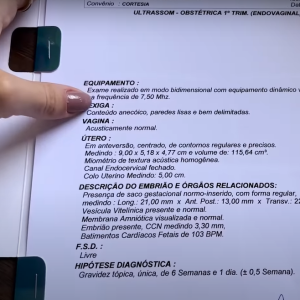 Virgínia Fonseca mostrou detalhes do exame de ultrassom da segunda gravidez e explicou que gestação está normal