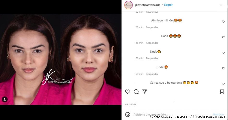 Resultado de harmonização de Eslovênia recebeu elogios nas redes sociais