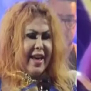 Rosto inchado de Joelma vinha preocupando os fãs da cantora