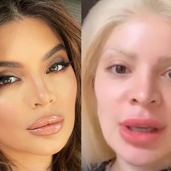 O antes e depois de Gkay agitou a web