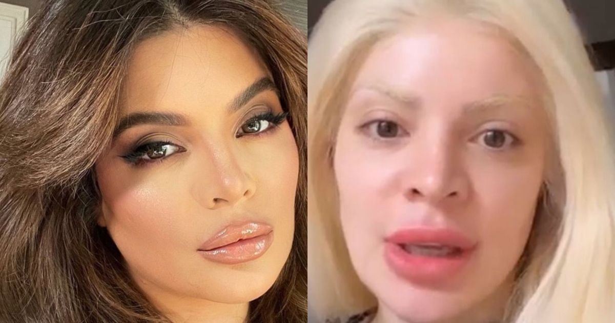 Antes E Depois De Gkay Apar Ncia Questionada E Influencer Reage Purepeople