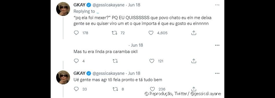 Na web, Gkay respondeu alguns seguidores sobre seus procedimentos estéticos
