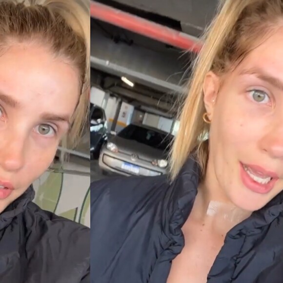 Após o diagnóstico de câncer, a ex-BBB Aline Gotschalg revela retirada da tireóide
 