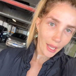 Aline Gotschalg contou que está fazendo uso da reposição hormonal sintética
 