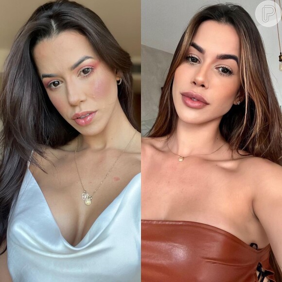 Ex-BBB Larissa Tomásia mostra o antes e depois após procedimento