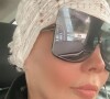 Simony sugiu com lenço na cabeça após quimioteparia