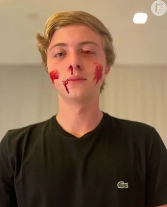 Halloween: Benício, filho Angélica e Luciano Huck, apareceu com manchas de sangue e machucados nas bochechas, na boca e no nariz