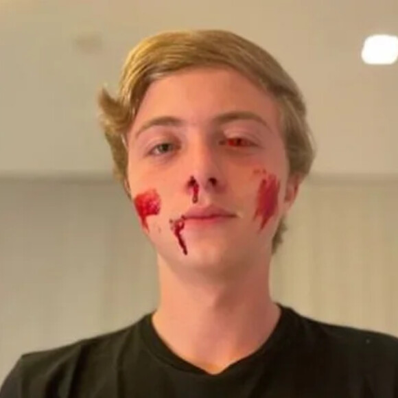 Halloween: Benício, filho Angélica e Luciano Huck, apareceu com manchas de sangue e machucados nas bochechas, na boca e no nariz