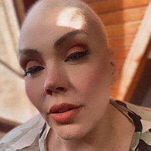 Simony perdeu o cabelo por causa da quimioterapia