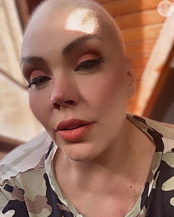 Simony perdeu o cabelo por causa da quimioterapia