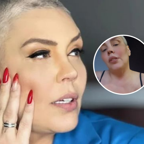 Simony mostrou uma marca no corpo por causa de uma válvula instalada para a quimioterapia