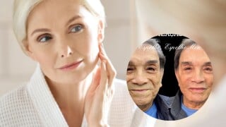 Harmonização facial pode ser feita na terceira idade? Procedimento de Dedé Santana viraliza e médico conta tudo!