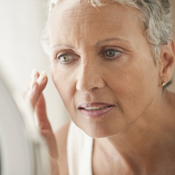 Preenchimento de olheiras após 60 anos não é indicado com ácido hialurônico